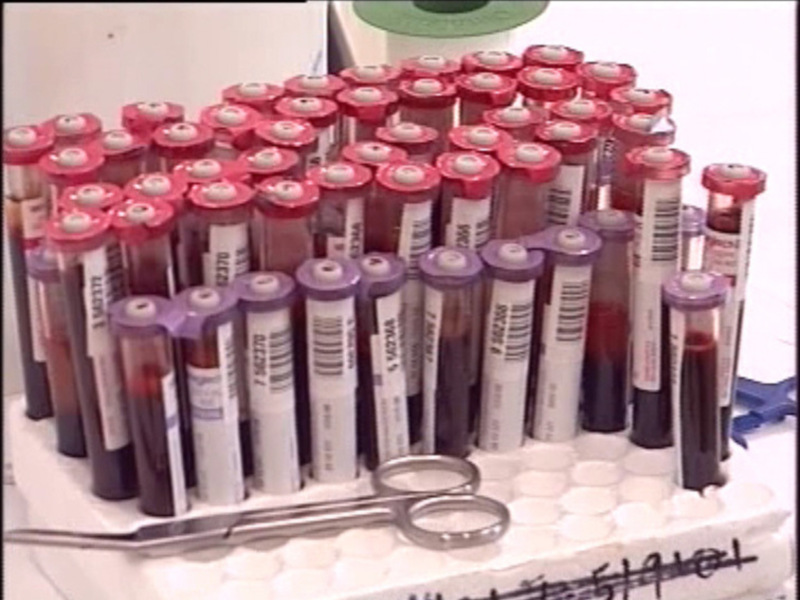 Pruebas de sangre en tubos de laboratorio con etiquetas y un par de tijeras en primer plano.