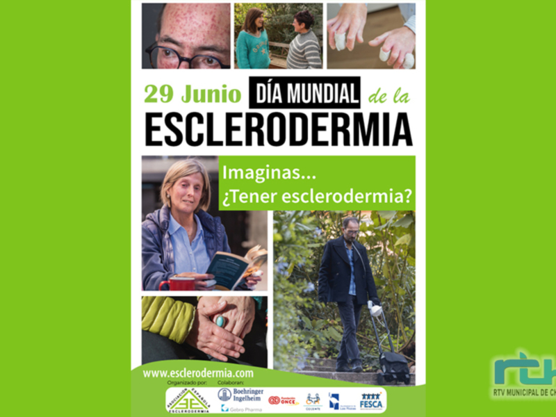 Chipiona visibiliza hoy 29 de junio la enfermedad de la Esclerodermia