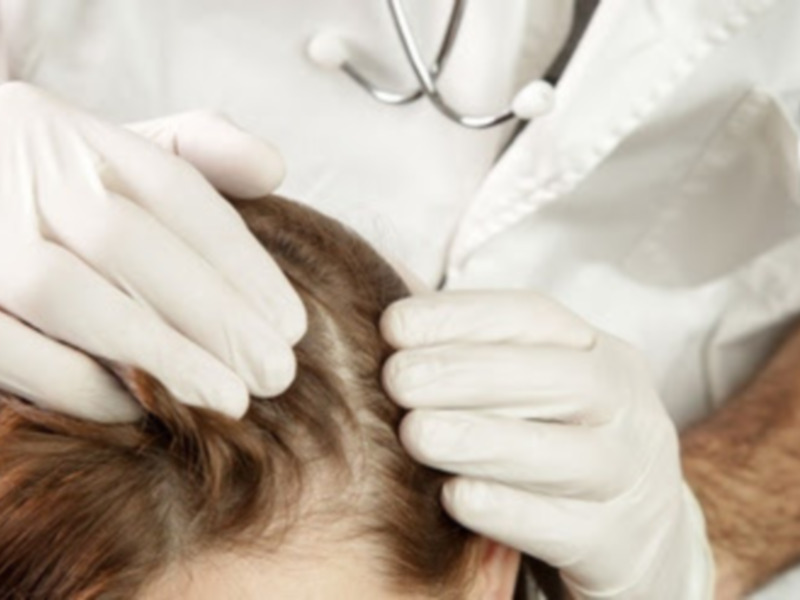 Psoriasis en época de frío: ¿qué la agrava y cómo se trata?